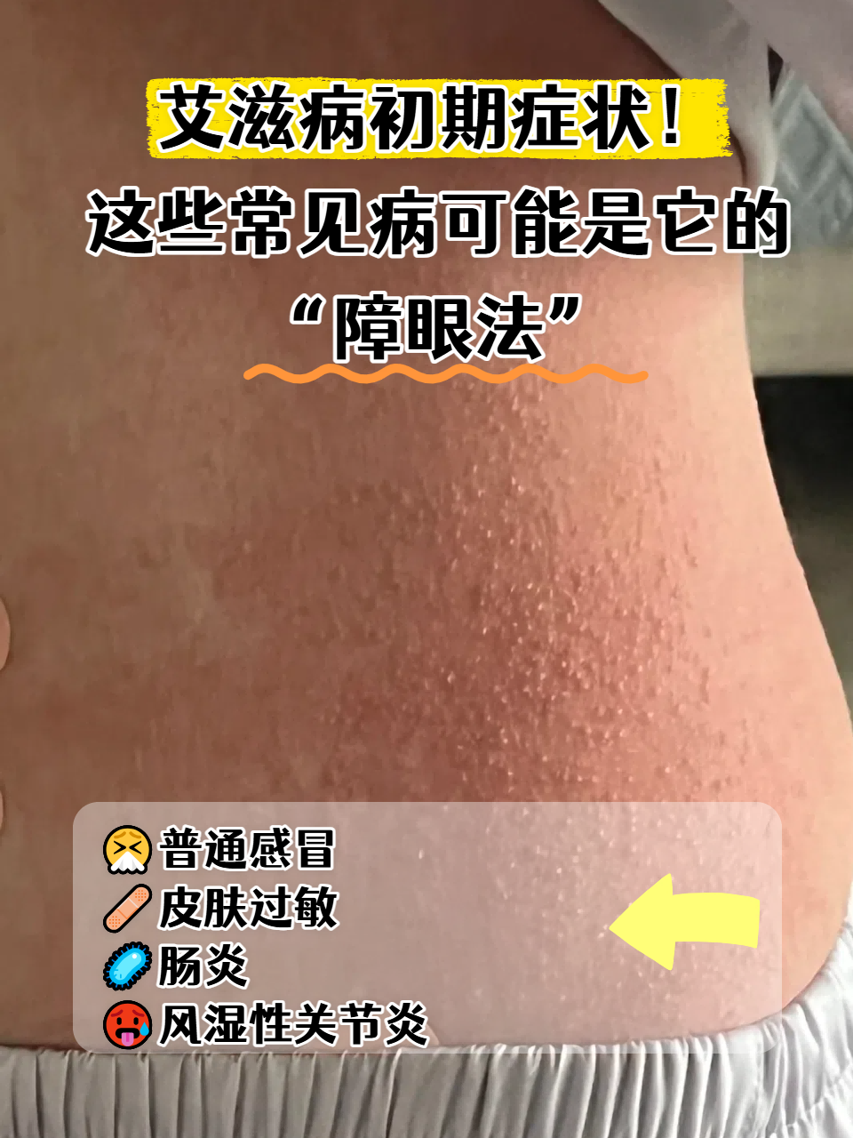 发现疫情的地区有哪些.发现疫情是什么症状?-第2张图片